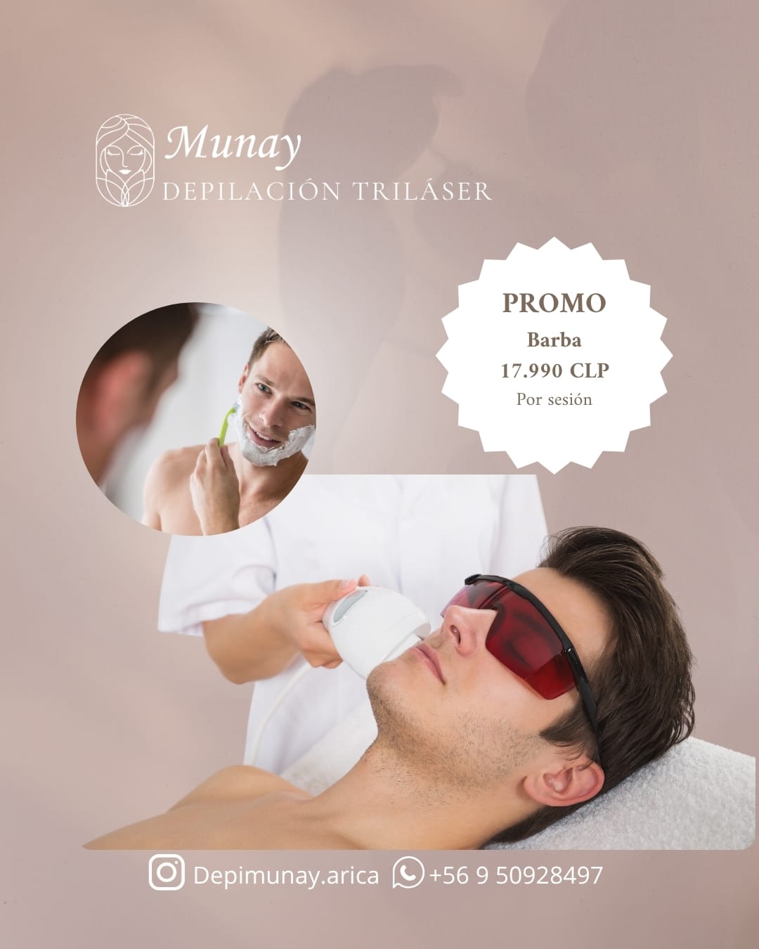 🌟 Depilación de Barba y Cuello con Proláser en Munay 🌟